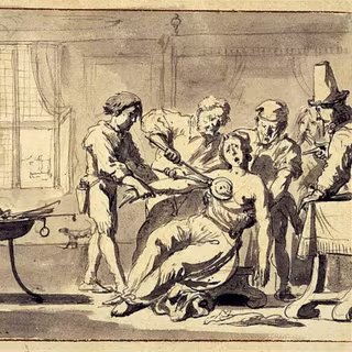 Aucun symptôme, aucune alerte : cette oncologue découvre soudain son cancer 4 Mastectomie pratiquée sans anesthésie sur une femme au XVIIIe siècle. © Wellcome Collection