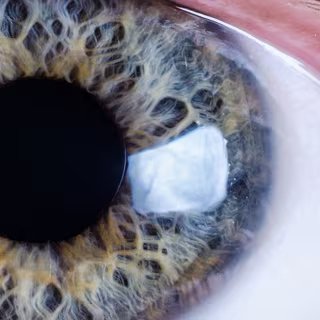 L’iris est la zone colorée de l’œil, visible à l’avant. Il s’agit en fait de la partie antérieure de la tunique vasculaire (choroïde). L’iris possède une ouverture en son centre : la pupille, ronde, qui laisse passer la lumière. Le diamètre de la pupille peut varier, laissant plus ou moins entrer la lumière, en fonction de la luminosité ambiante. L’iris contient un pigment brun plus ou moins abondant.
© Mattis2412, CC by-sa 3.0