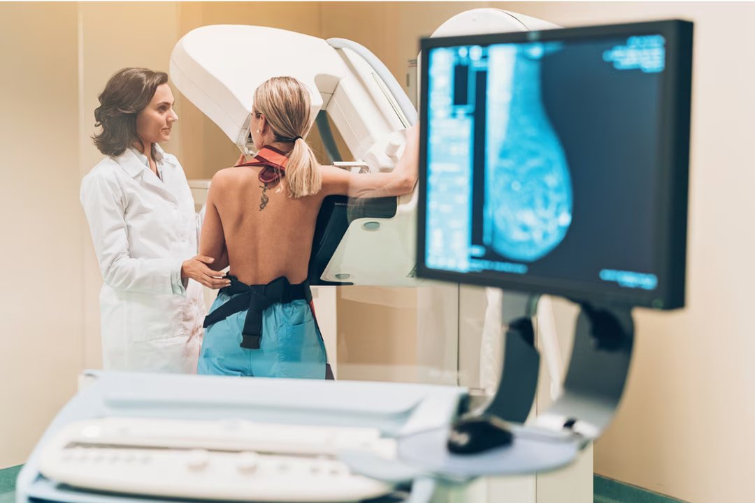 mammographie cancer sein prevention