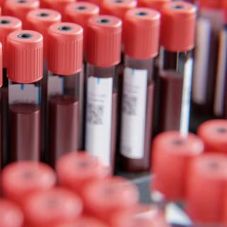 Des analyses sanguines menées sur vingt ans montrent une évolution claire des concentrations en dioxyde de carbone (CO2) dans le sang des êtres humains. Une évolution qui semble suivre celle des concentrations dans l’atmosphère et qui inquiète les chercheurs du Kids Research Institute (Australie). Ils expliquent. © Steffen Kögler, Adobe Stock