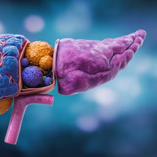 La résistance des tumeurs réduit l’efficacité des traitements du cancer du pancréas ; une trithérapie testée en laboratoire ouvre la voie à de futures thérapies combinées. © ulf mine, Adobe Stock