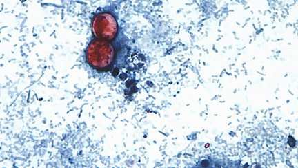 L'image, fournie par les Centres pour le contrôle et la prévention des maladies américains, montre une vue au microscope d'oocystes du parasite "Cyclospora cayetanensis", qui provoque la cyclosporose. (Melanie Moser / AP / SIPA)