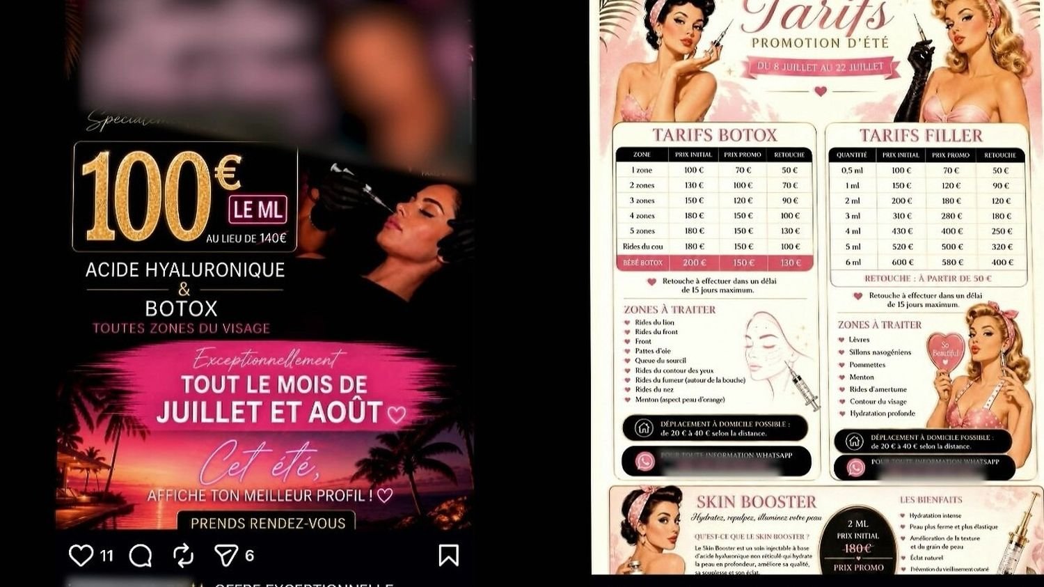 Injections esthétiques illégales : les médecins tirent la sonnette d'alarme